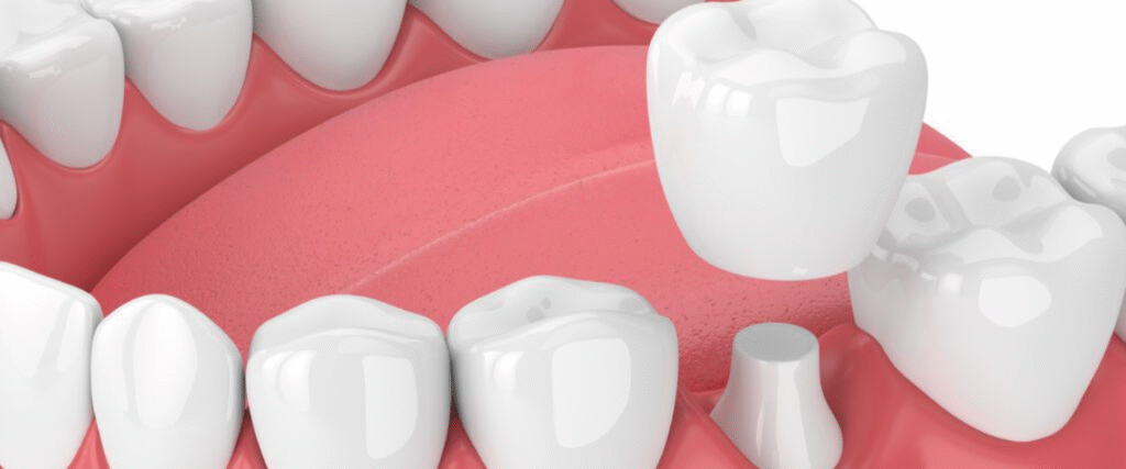 Tooth Extraction in Lamesa Dental