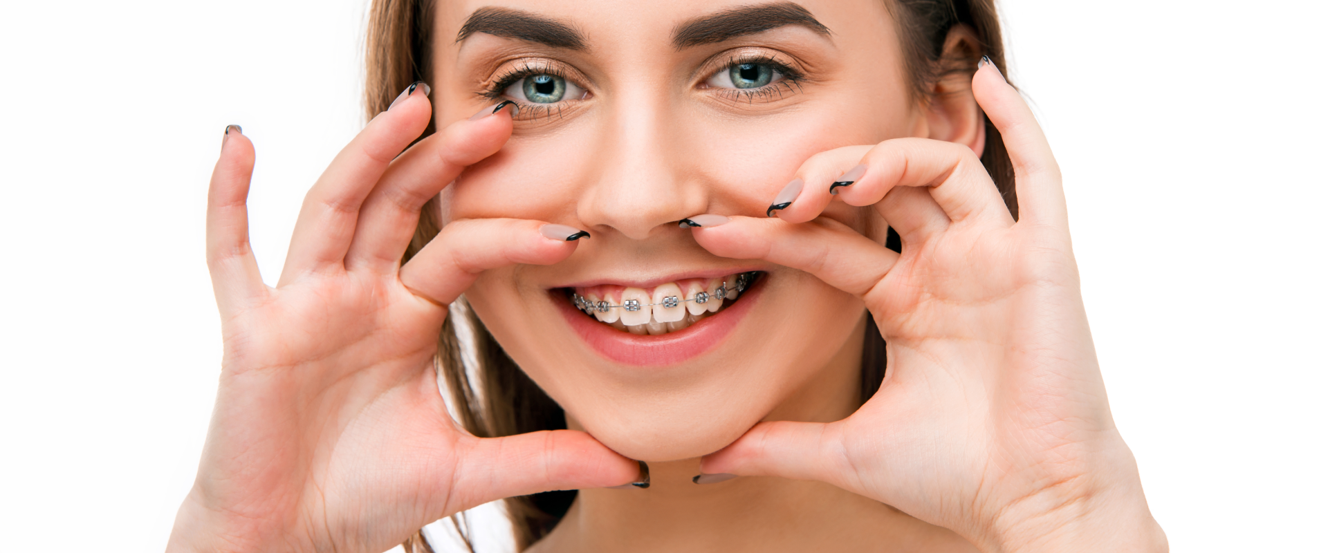 Braces in Lamesa TX
