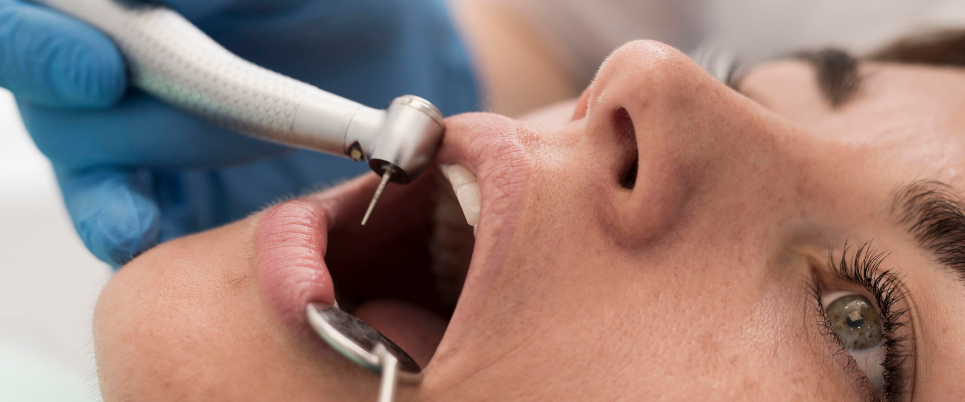 Root Canal Lamesa TX