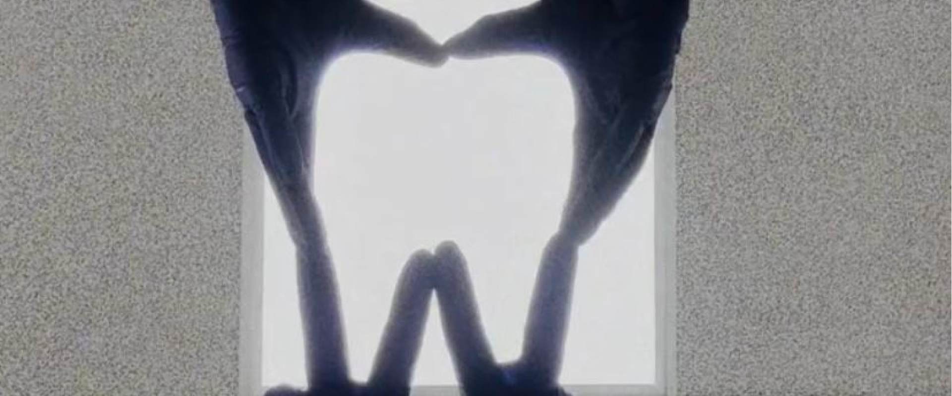 Fixed Bridges Lamesa