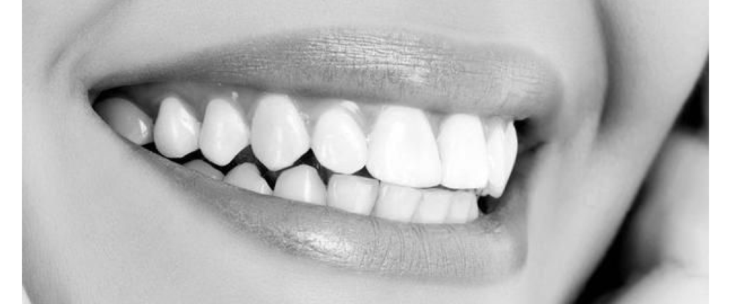 Root Canal Treatment Lamesa