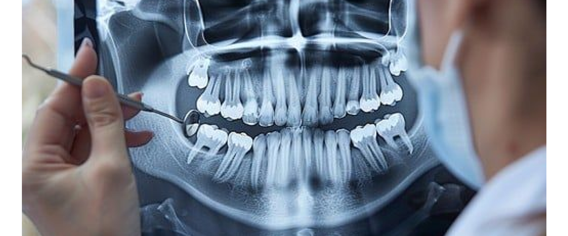 Cigna Dental Insurance Lamesa