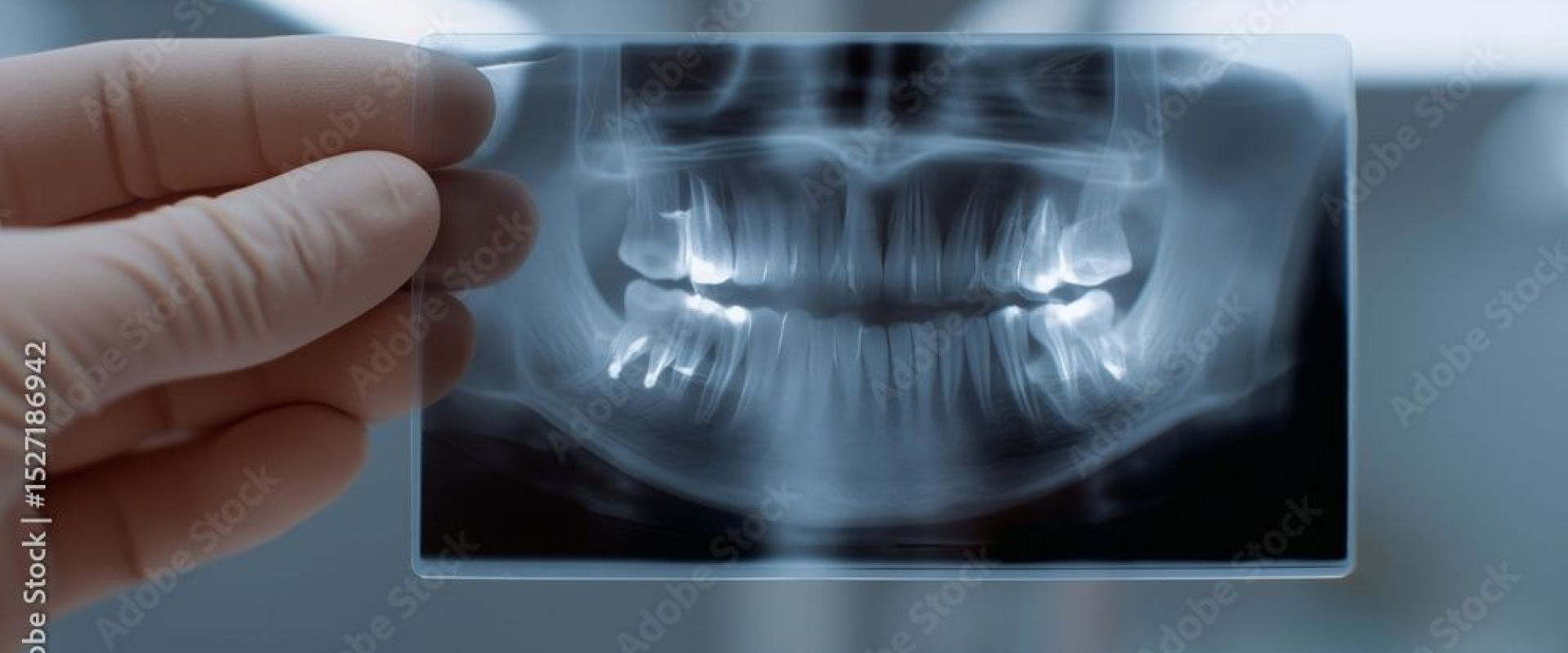 Digital X-Rays in Lamesa TX