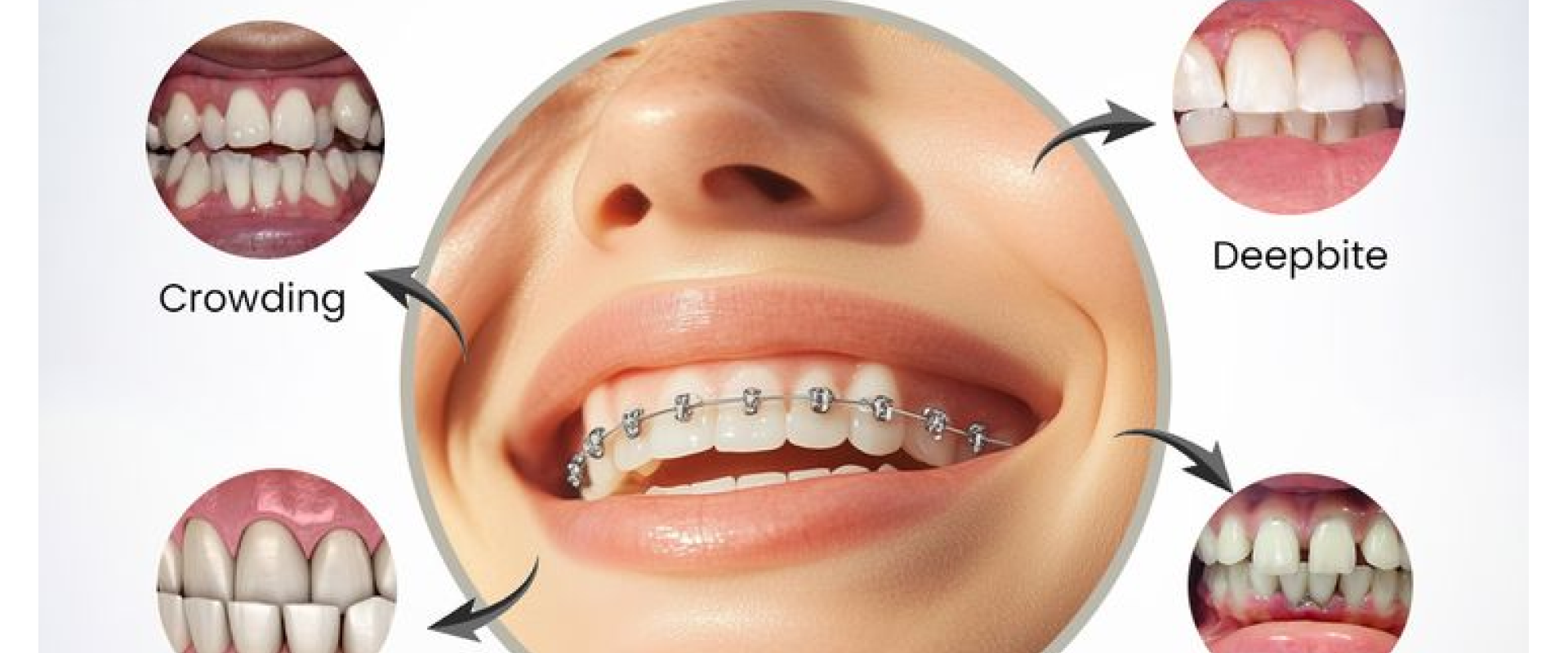 dentist near me in Lamesa TX